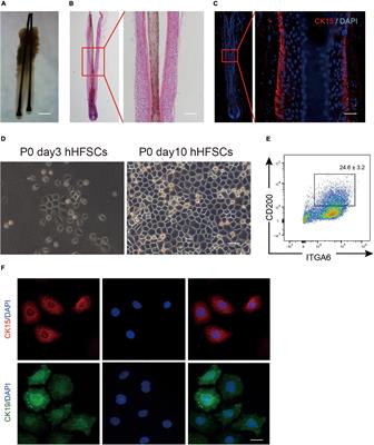 Establishment of an Efficient Primary Culture System for Human Hair Follicle Stem Cells Using the Rho-Associated Protein Kinase Inhibitor Y-27632